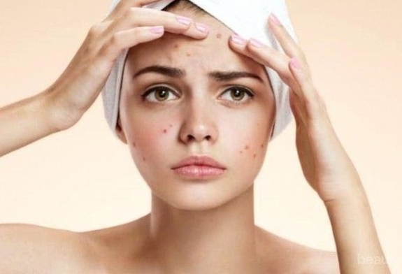 5 Rekomendasi Sunscreen Untuk Kulit Sensitif Dan Berjerawat