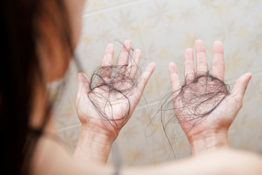 Faktor di Balik Rambut Rontok