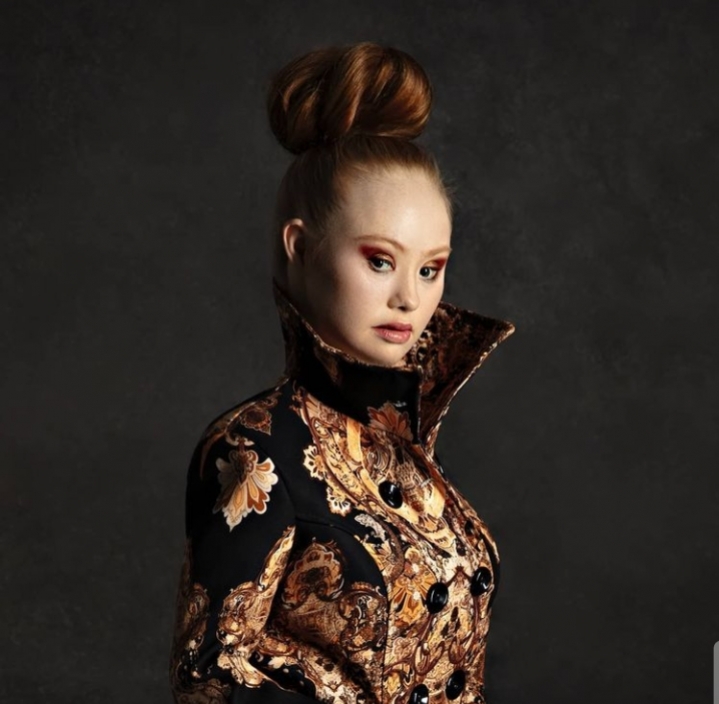 Inspiring! Inilah Model Disabilitas Yang Bangkit Dengan Prestasinya